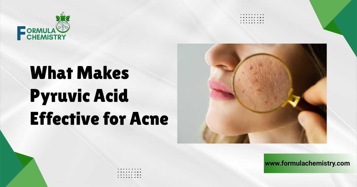 what makes pyruvic acid effective for acne
